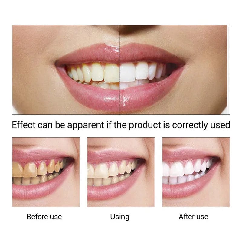 Teeth Whitening Essence Powder Oral Hygiene Cleaning Serum Removes Plaque Stains Tooth Bleaching Dental Tools Toothpaste