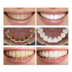 Teeth Whitening Essence Powder Oral Hygiene Cleaning Serum Removes Plaque Stains Tooth Bleaching Dental Tools Toothpaste