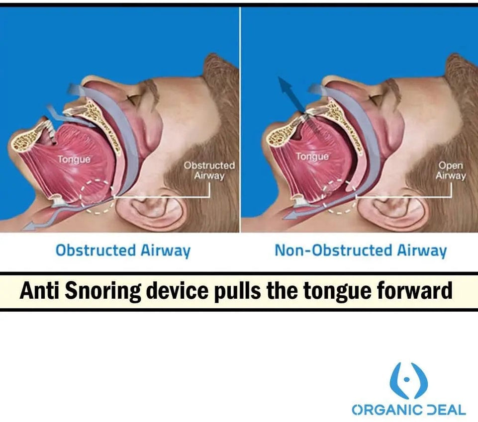 Anti Snoring Mouthpiece Tongue Retainer Helps to Eliminate Snoring Anti Snore Device Silicone Snore Sleep Apnea Anti Ronflement