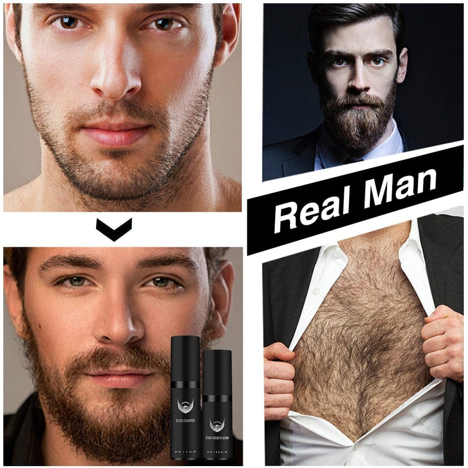 Beard Growth Kit Hair Growth Enhancer Thicker Oil Nourishing Leave-in Conditioner Beard Grow Set with Beard Growth roller
